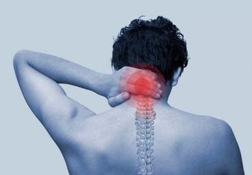 a nyak osteochondrosisának belső tünetei