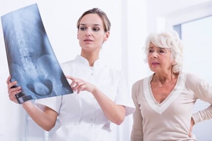 A röntgenvizsgálat informatív módszer a gerinc osteochondrosisának diagnosztizálására
