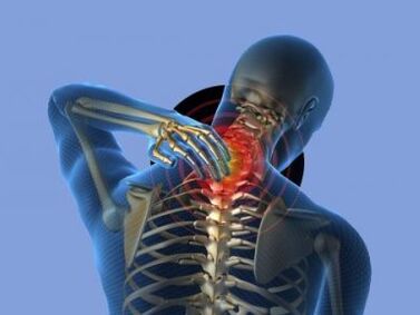 A nyaki gerinc osteochondrosisában szenvedő személyt a nyaki fájdalom zavarja
